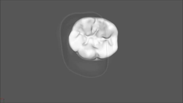 Dynamic Modelling of Tooth Deformation Using Occlusal Kinematics and Finite Element Analysis смотреть онлайн