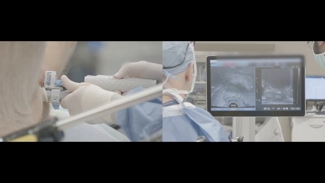 Targeted and Systematic Prostate Biopsy смотреть онлайн