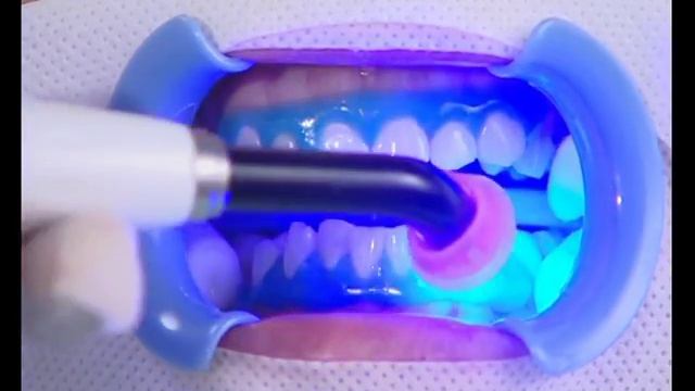 BEYOND™ Polus® Whitening Accelerator смотреть онлайн