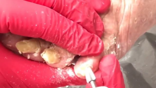 Сложная зачистка ногтей смотреть онлайн