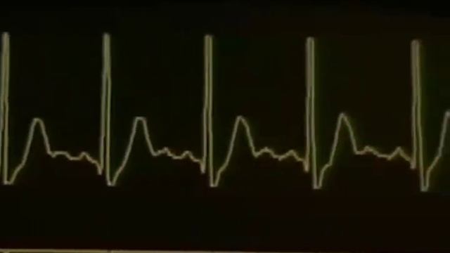 Laurie Anderson - Freefall смотреть онлайн