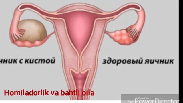 TUHUMDON KISTASI QANDAY YUZAGA KELADI? ТУХУМДОН КИСТАСИ смотреть онлайн