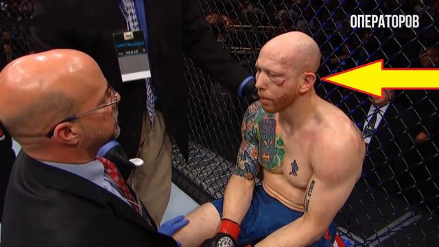 УЖАСНАЯ ТРАВМА! ПЕРЕЛОМ ЛИЦЕВОЙ КОСТИ В БОЮ СТИВЕНС - ЭММЕТТ UFC ON FOX 28 смотреть онлайн