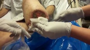 Опарыши в ране!!