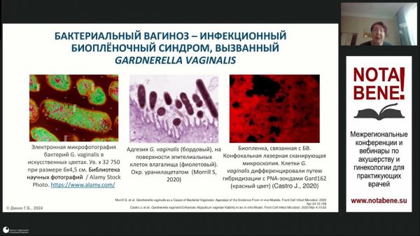 Мастер-класс "NOTA BENE!" - Рецидивирующий бактериальный вагиноз и его связь с бесплодием.