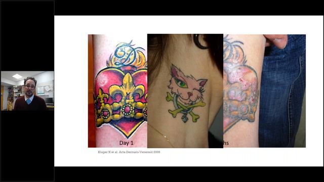 Tattoos and Immune mediated diseases - Tuesday lunch with RITA - Guest speaker: Nicolas Kluger смотреть онлайн
