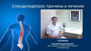 Спондилоартроз: причины и лечение
