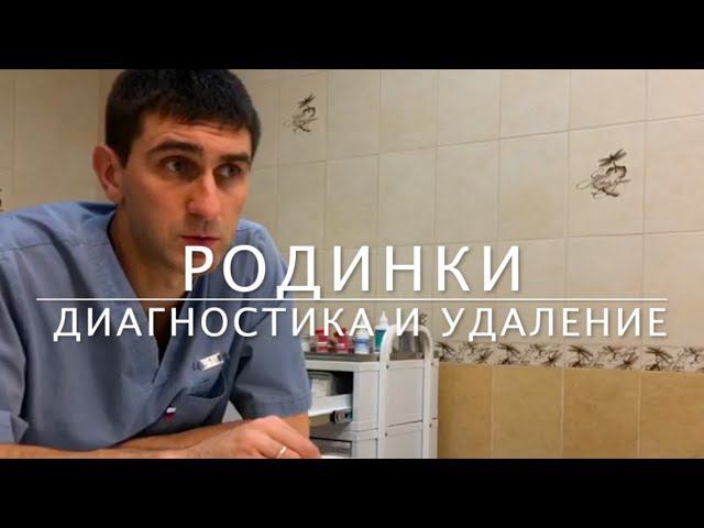 РОДИНКИ - ответы хирурга-дерматоонколога на вопросы смотреть онлайн