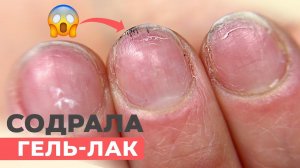 СОРВАЛА ногти с гель-лаком | Что будет если содрать гель-лак?