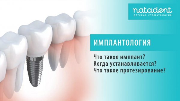 35. Что такое имплантация и протезирование зубов? Натадент
