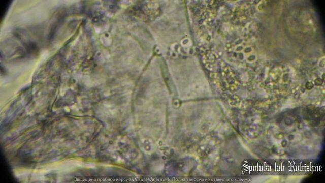 тля теплокровных (мелкие и микроскопические клещи размером 0,1мм)- Клещевой Трансмиссивный Бациллё смотреть онлайн