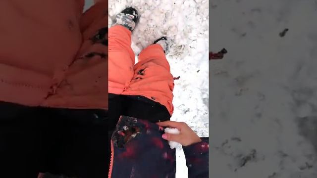 Девушка получила химический ожог от загоревшегося айфона!!!!1111 смотреть онлайн