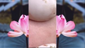 Выдавливание чёрных точек НОВОЕ! Удаление чёрных точек за ухом. p14