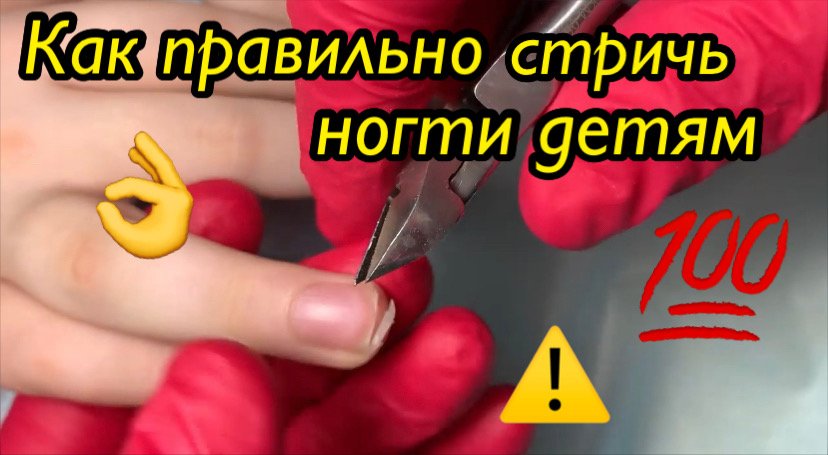 Как правильно стричь ногти детям??❗️ смотреть онлайн