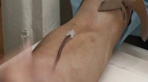 переливание крови