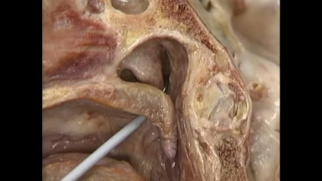 ГОЛОВА И ШЕЯ. | Атлас анатомии Акланда  Фильм 4