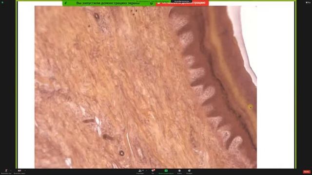 Консультация ко 2 коллоквиуму - Кутукова К.А. смотреть онлайн