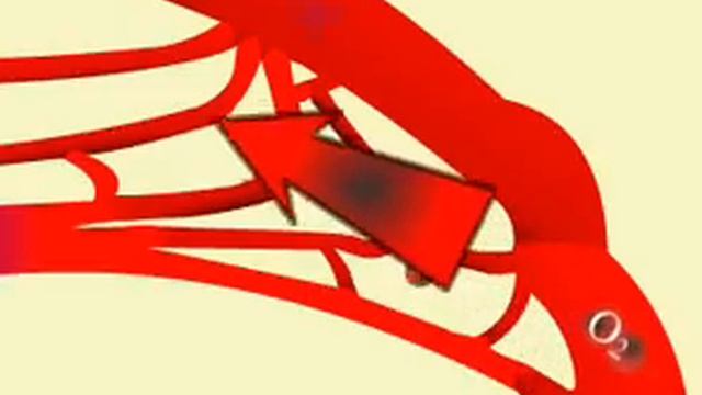 Большой круг кровообращения.avi смотреть онлайн