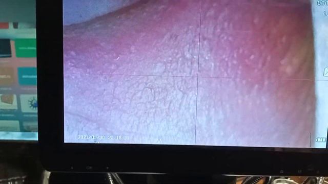 Микроскоп DM9 HD. Краткий обзор в домашней лаборатории. смотреть онлайн