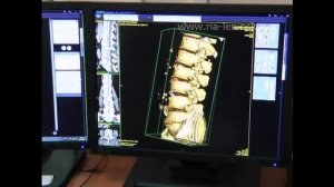 Как получить квоту на МРТ