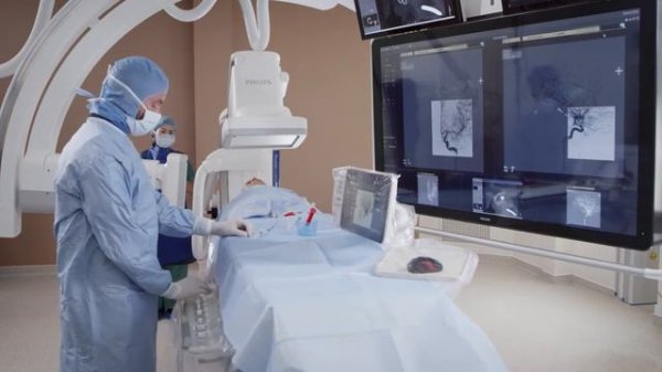 АНГИОГРАФ Azurion 7 B20