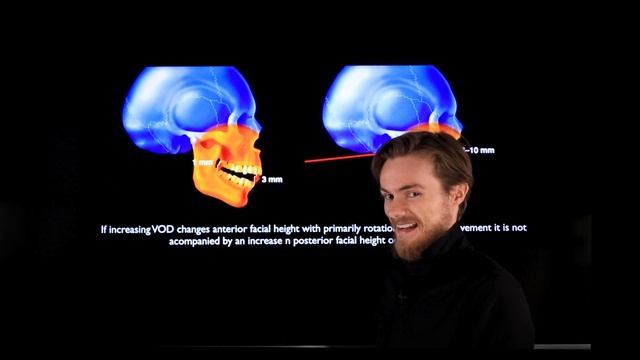 Can your bite be too high ? смотреть онлайн