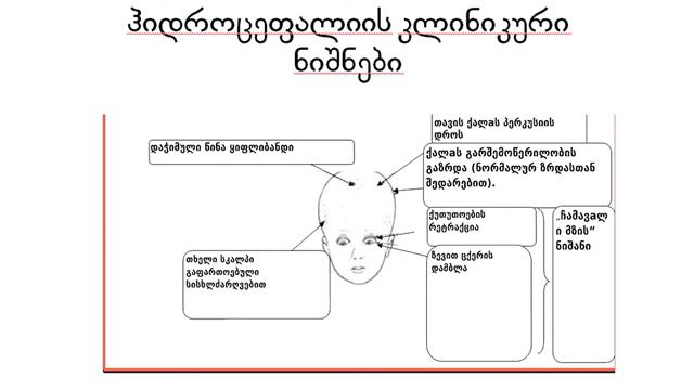 ჰიდროცეფალიის დიაგნოსტიკა და მართვა-პროფესორი ნანა ტატიშვილი смотреть онлайн