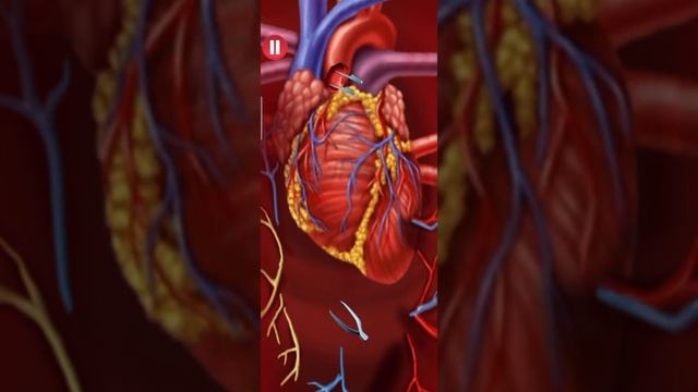 Open Heart Surgery Doctor Game Android Gameplay HD смотреть онлайн