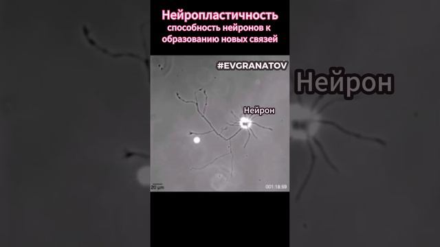 Ужас! Посмотрите как растут нервные клетки #evgranatov #рассеянныйсклероз #рс #shortsvideo #short смотреть онлайн