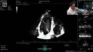 Измерение и расчеты в ЭхоКГ. Измерение объемов левых камер сердца. Благодир Б.В.