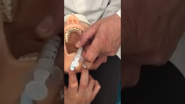 Палатинальная анестезия