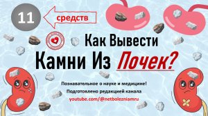 Как вывести камни из почек: 11 средств (методов) для лечения мочекаменной болезни