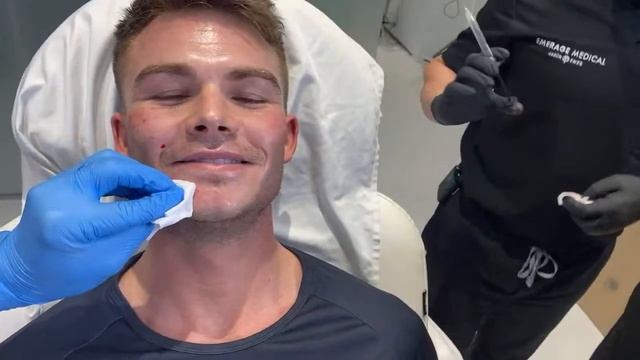 HOW TO LOOK LIKE A MODEL IN 20 MINUTES | MALE FACIAL SCULPTING | Dr. Jason Emer смотреть онлайн