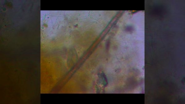 коллаж микромир