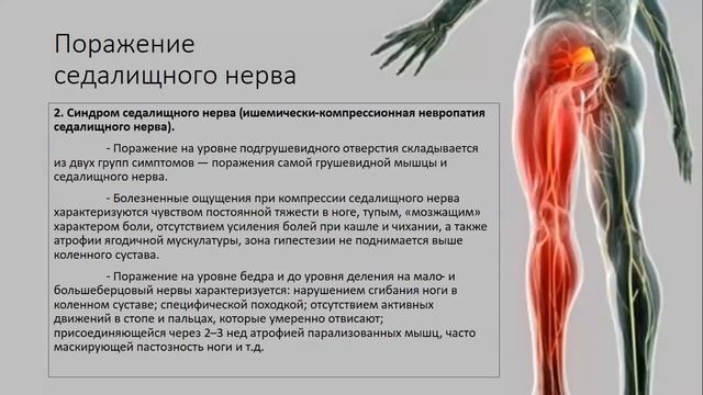 29 Седалищный и бедренный нервы смотреть онлайн