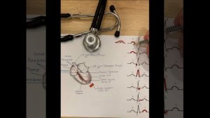 Основы ЭКГ легко и просто!