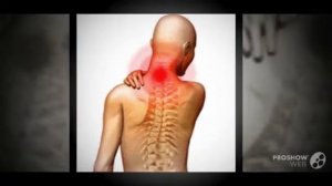 Почему хрустит шея боли в шее при повороте головы что делать видео