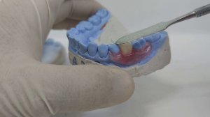 Протез бабочка🦋