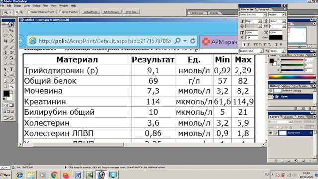 трийодтиронин Т3 от ZPHC результат анализа смотреть онлайн