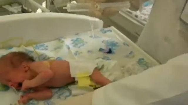 Зондування шлунку та проведення проби Елефанта смотреть онлайн