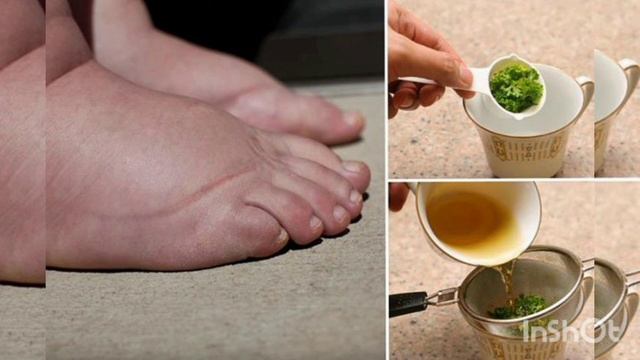 Ոտքերի այտուցը բուժեք շատ արագ смотреть онлайн