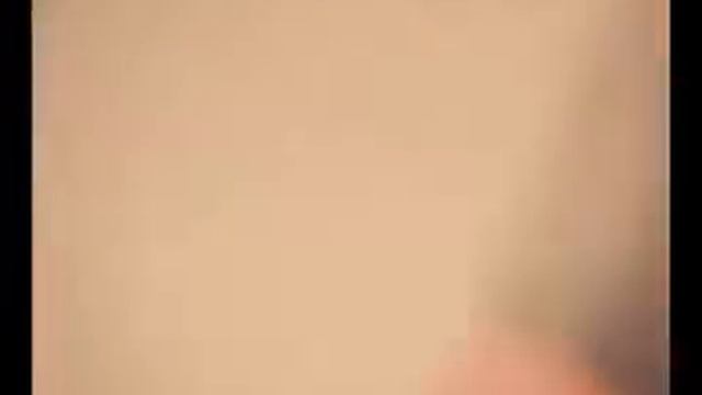 Ядовитая змея скрежета укусила мужика за руку смотреть онлайн