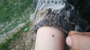 Внимание, опасность! Нашествие Клещей! Клещ крупным планом.