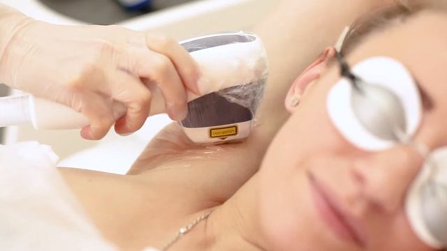 Пример проведения лазерной эпиляции смотреть онлайн