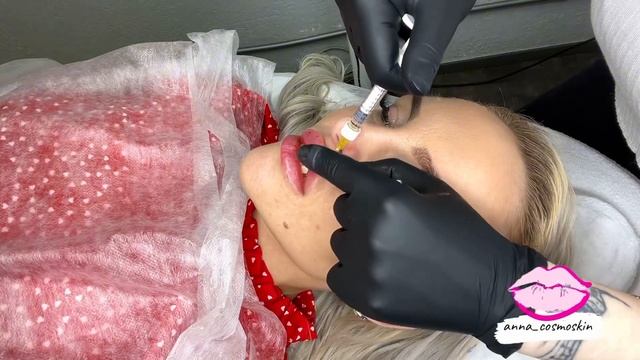 Губы в технике плоский бант ,секреты идеальных губ #губымосква #губы #ботокс смотреть онлайн