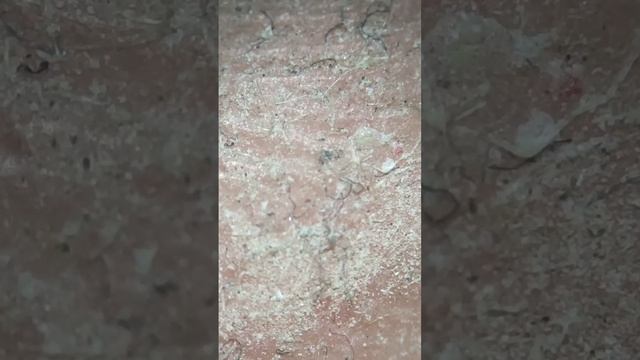 РУКА ПОД МИКРОСКОПОМ смотреть онлайн