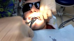 Как снимают брекеты.