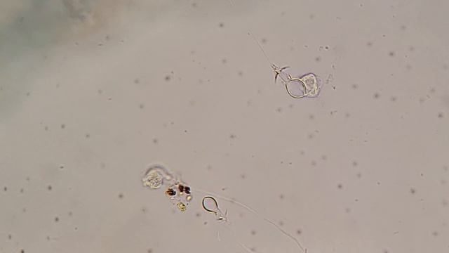 Biology Research Project: Stinging Cells in Hydra смотреть онлайн