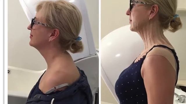 Семинар по эстетической реабилитации, кинезиотейпирование