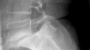 8. МЕДИЦИНА. Листезы.avi